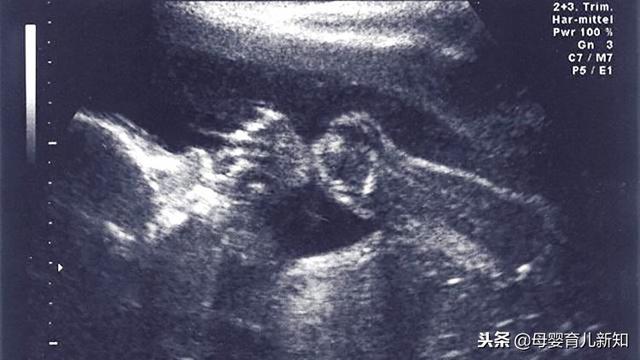 分娩的时候宝宝跟你一起在努力？6个你不知道的胎儿小知识