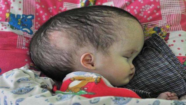 生孩子前这4个项目，男人也要一一检查，不然容易生下畸形儿