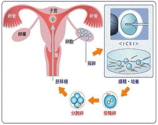 辟谣：试管婴儿的孩子没有自然妊娠的孩子健康，错，别再乱传了