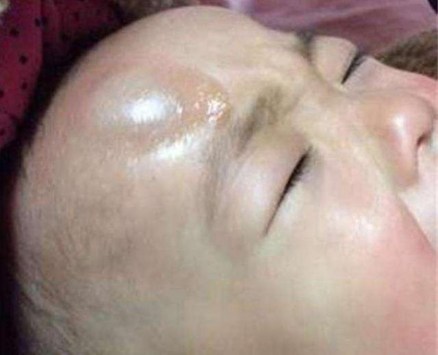 儿子半夜摔下床没哭，宝妈以为没事就睡了，第二天瘫软在地
