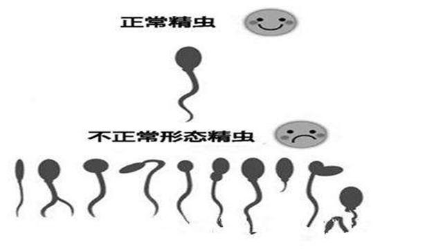 生孩子前这4个项目，男人也要一一检查，不然容易生下畸形儿