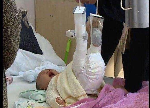 孩子4个月就双腿骨折，奶奶认为没事，医生怒骂：无知家长害孩子
