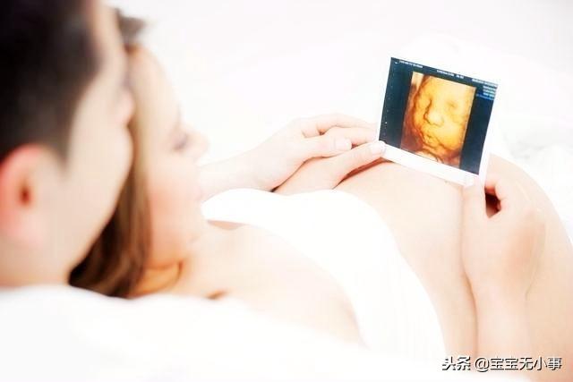 到了孕晚期，为何产检越来越频繁？孕妇有必要提前了解
