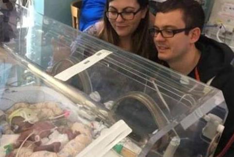 悲伤又伟大：孕妇生下一斤重龙凤胎 一周内两个宝宝都离世