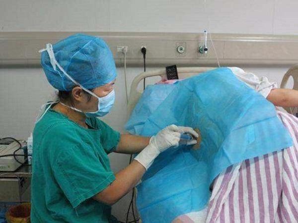 剖腹产对女性伤害有多大？医生划分了四个等级，第四个真让人遗憾