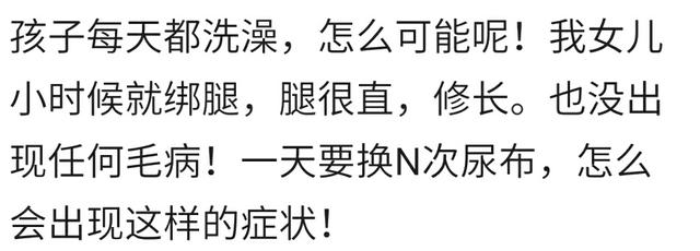 为了防止出现罗圈腿，你会听婆婆的话给宝宝绑腿吗？看宝妈怎么做