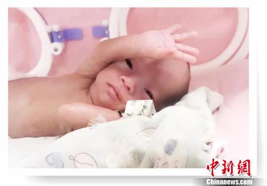 成都一对双胞胎出生时比矿泉水瓶还小 如今健康成长