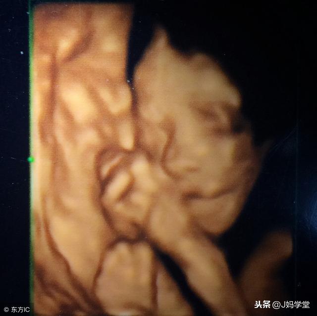 看到宝宝的四维照片后，妈妈伤心了，为何这么丑？原因在这