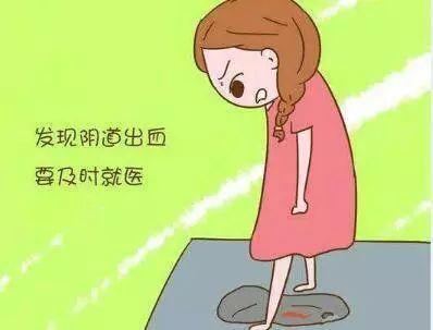 孕早期出血不要慌
