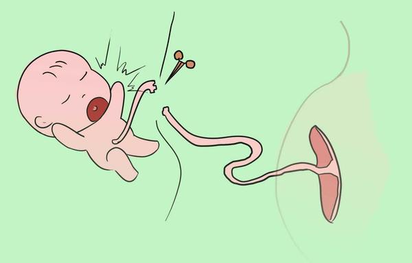 新生儿脐带虽小，但护理起来别大意！四个注意事项要了解
