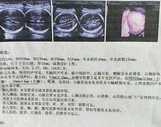 儿女双全啦，和怀女儿不一样，附男孩症状，接好孕