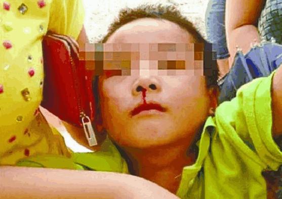 孩子不就是流鼻血吗，怎会被宣告死亡？医生：因为妈妈的无知