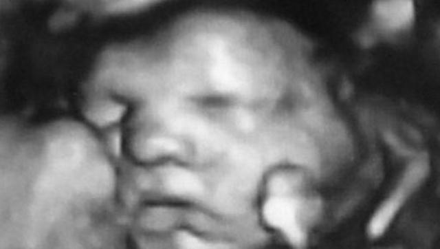 孕妇做B超时商量取名字，宝宝一个手势惊呆爸妈