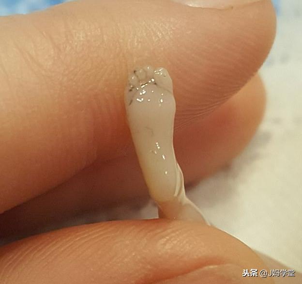 母亲分享流产14周的胎儿照片，胎儿10厘米已成型，劝大家不要堕胎