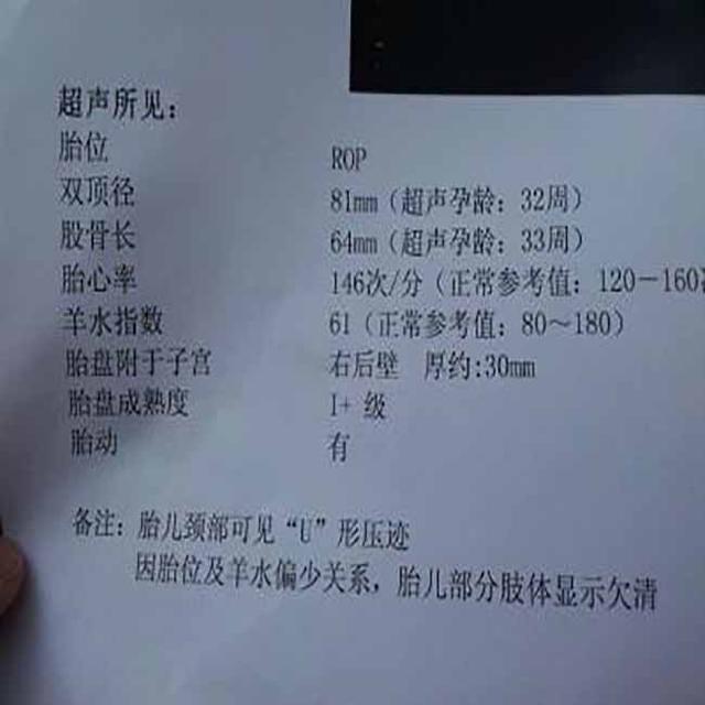胎儿过小是因为孕妈吃得少造成了孩子营养不良吗？五种情况