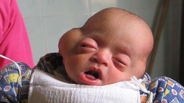 不想宝宝畸形,别在这4种情况下意外怀孕,但很多女人却不知道