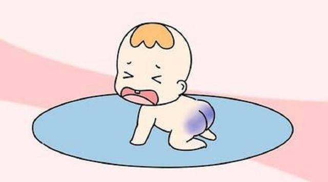 宝宝出生时屁股上有淤青？恭喜你！这说明宝宝很爱你！