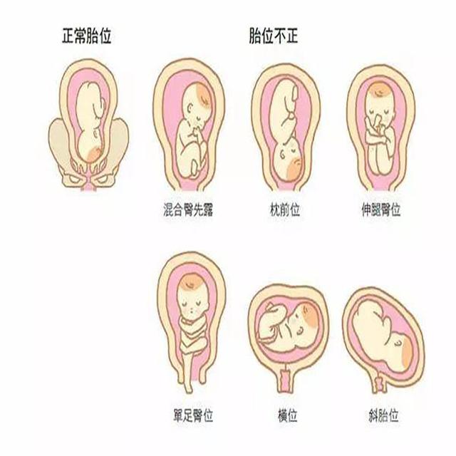 怀孕34周，是怀孕的第几个月？你想了解的真相都在这里，别不在意