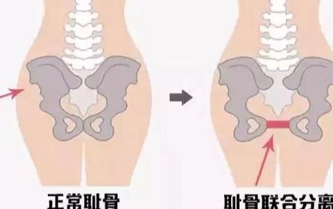 怀孕的时候没注意，产后被这个病折磨了7年！这个病，要早知道