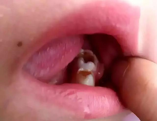这件事关系孩子一生的健康，90%的妈妈却没做好