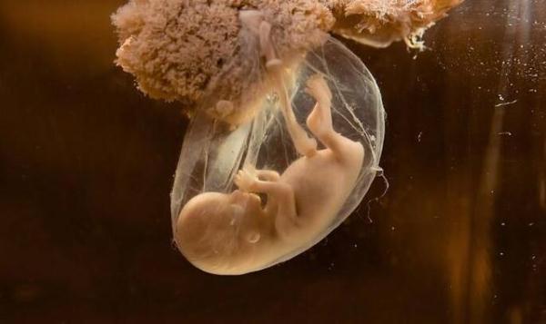 奇葩！胎宝宝是喝羊水长大的？看下都在子宫里干什么？