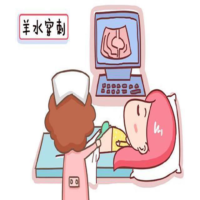孕产说：有人说唐筛通过率低，不如直接做羊水穿刺，对此你怎么看