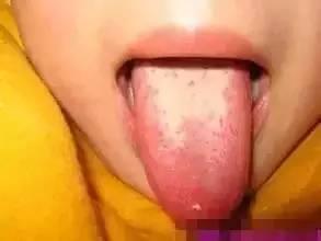 天然止咳方：温开水泡开，不管多狠的咳嗽，咳立除！