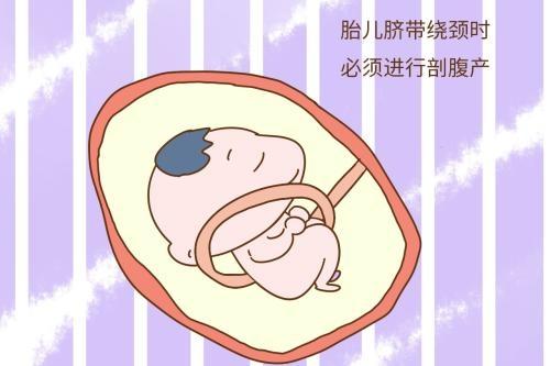 原来剖腹产取出胎儿的时间是有要求的，快来长知识吧