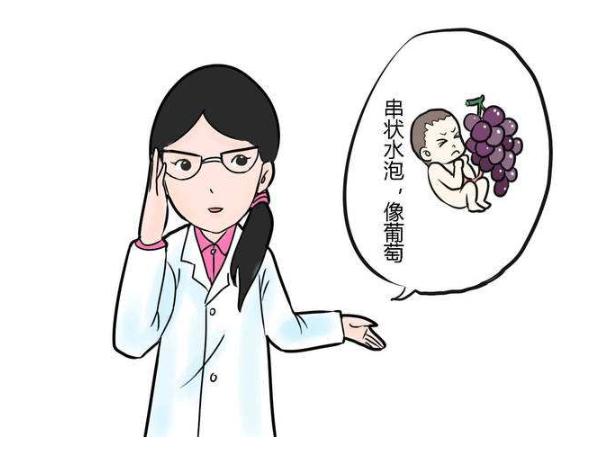 女子怀孕2月第一次检查，结果有点懵：怀了一肚子“葡萄”？