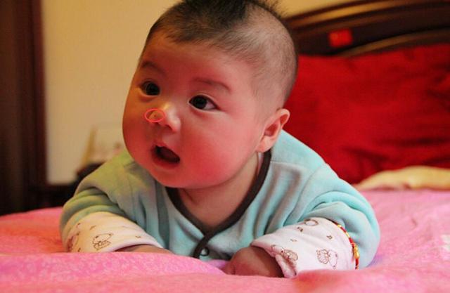 宝宝有胎记很正常，但出现这4种变化就不得不防，好痣可能要变坏