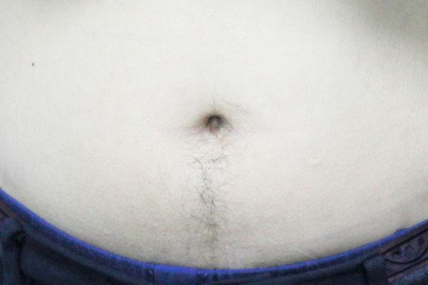 肚脐眼能扣吗？肚脐形状能反映出健康情况吗？