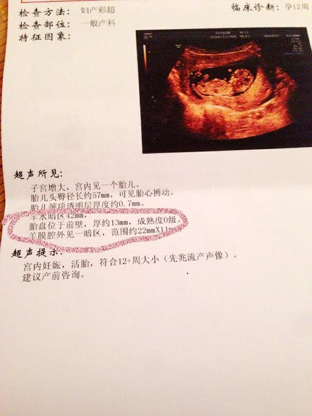 孕妇胎盘前壁好还是后壁好？只要在这个位置都正常，变化了就不行