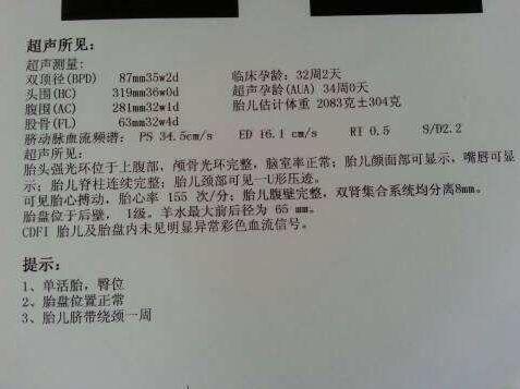 当B超单显示臀位，就一定要剖腹产吗？6周内调成头位，还可顺产