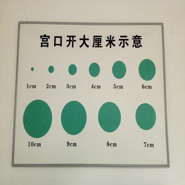 顺产大喊大叫？NO!说说的生产经历和产后经验？