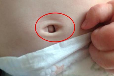 宝宝身上这3个部位再脏,“强迫症”妈妈也要手下留情,不能乱碰