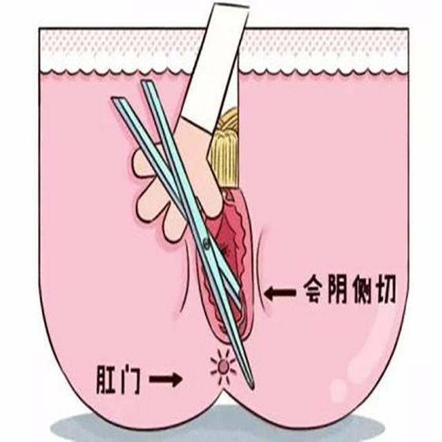 顺产大喊大叫？NO!说说的生产经历和产后经验？