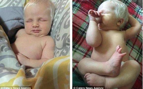 美国一新生儿头发亮白如雪，一出生就令家人错愕不已