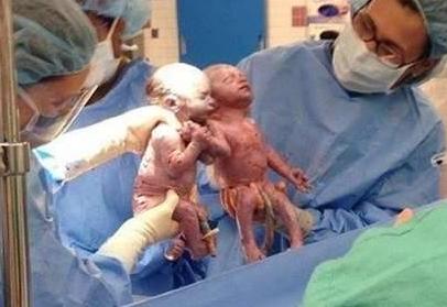 双胞胎姐妹花手牵手出生，2岁依旧“手牵手”形影不离