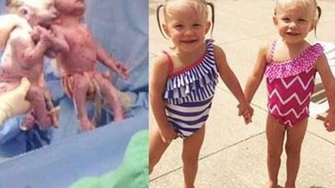 双胞胎姐妹花手牵手出生，2岁依旧“手牵手”形影不离