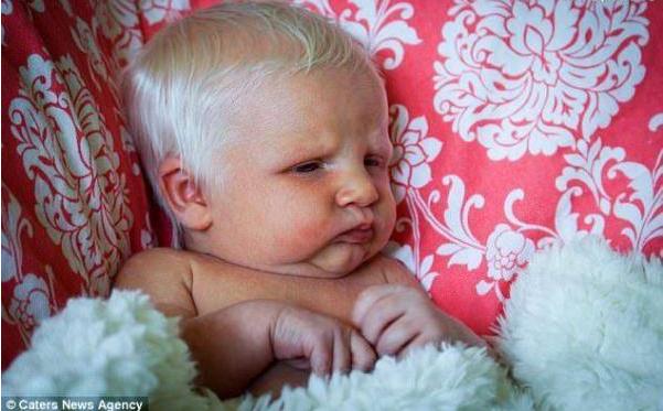 美国一新生儿头发亮白如雪，一出生就令家人错愕不已