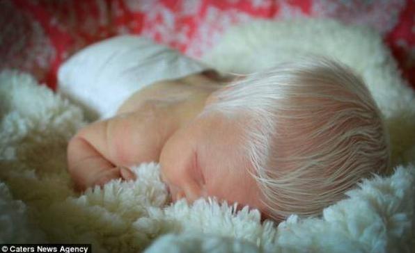 美国一新生儿头发亮白如雪，一出生就令家人错愕不已