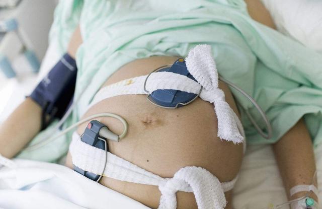 孕妈分娩时的6件尴尬事:其实没必要啦,医生都见怪不怪了