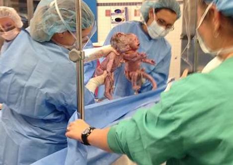 双胞胎姐妹花手牵手出生，2岁依旧“手牵手”形影不离