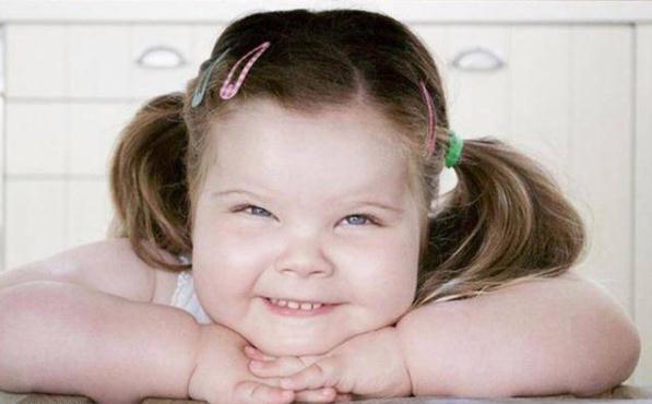 小女孩患罕见病4岁体重就超过8岁孩子，并且无法阻止发胖