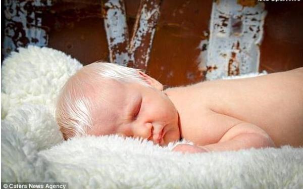 美国一新生儿头发亮白如雪，一出生就令家人错愕不已