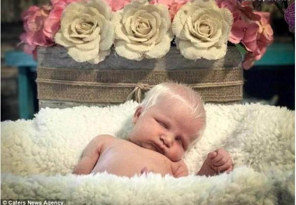 美国一新生儿头发亮白如雪，一出生就令家人错愕不已
