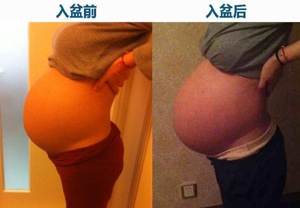 胎儿入盆胎动变化大，这3种情况你肯定遇到过1种，早知道不紧张