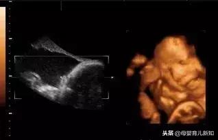 看到四维彩超的时候觉得自己宝宝超丑？为了宝宝美也是拼了