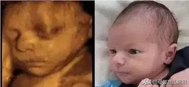 看到四维彩超的时候觉得自己宝宝超丑？为了宝宝美也是拼了