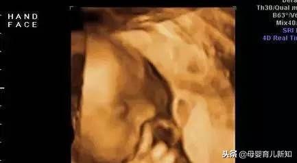 看到四维彩超的时候觉得自己宝宝超丑？为了宝宝美也是拼了